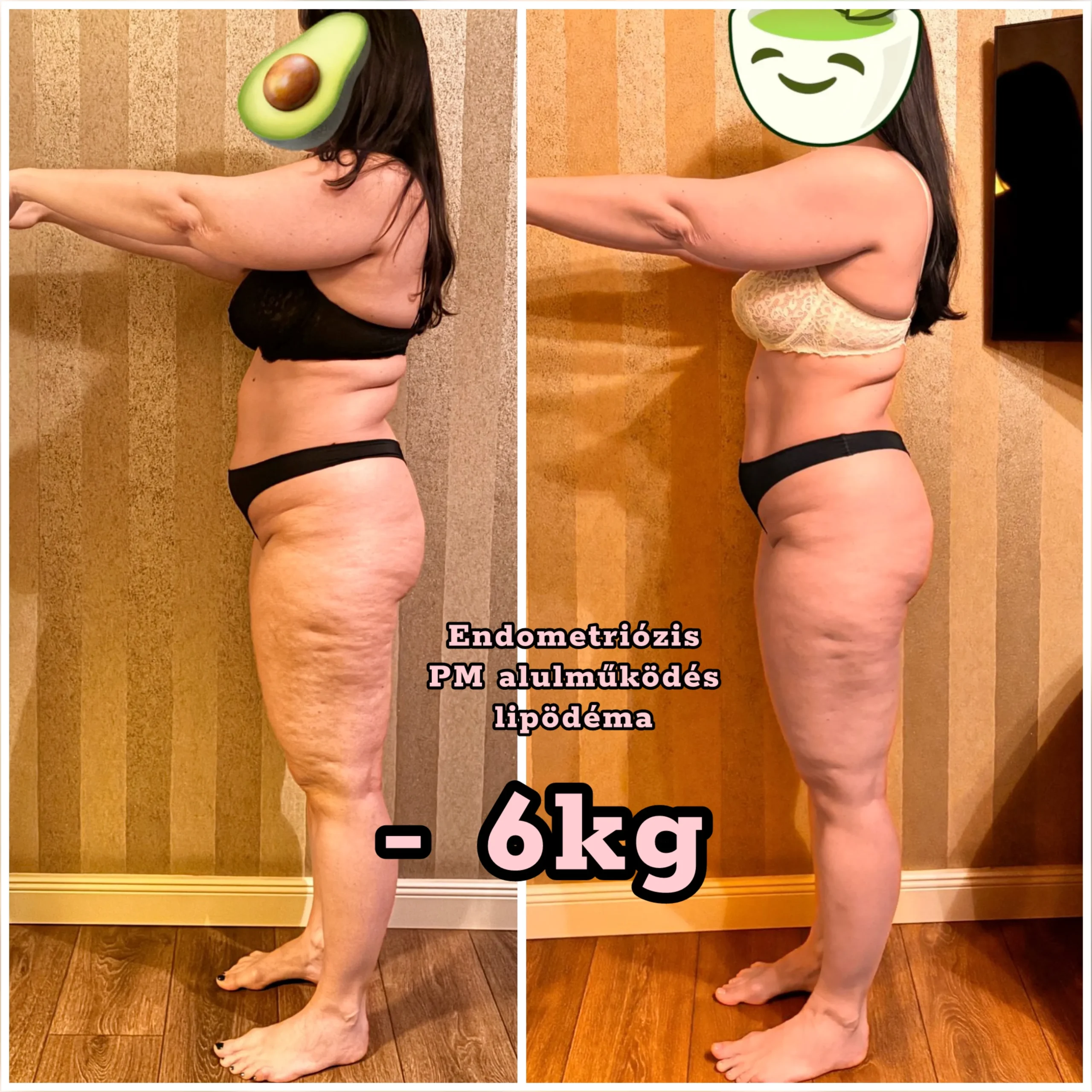 before-after-26-05-04-10